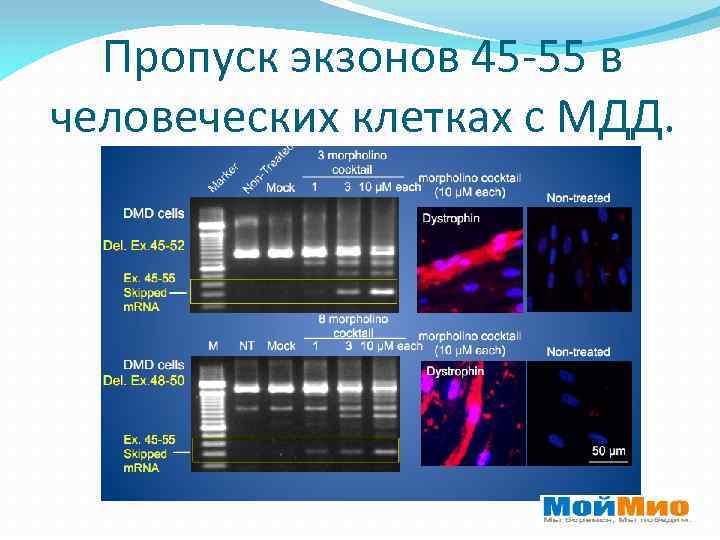 Экзон рф 2023. Экзоны Гена DMD. Ген DMD Экзон 39 с5530с>t. Миодистрофия пропуск экзона 50 разработка испытания. Таблица экзонов.