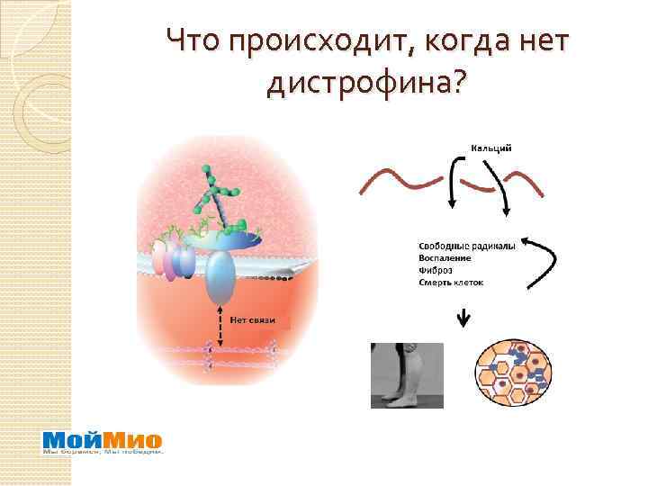Что происходит, когда нет дистрофина? 