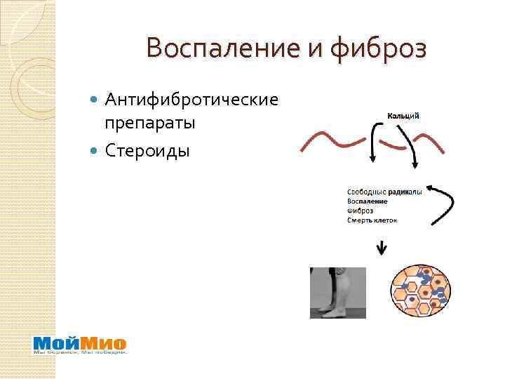 Воспаление и фиброз Антифибротические препараты Стероиды 