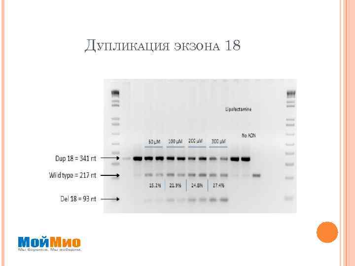 ДУПЛИКАЦИЯ ЭКЗОНА 18 