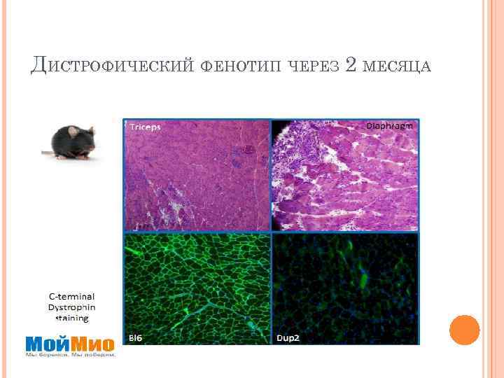 ДИСТРОФИЧЕСКИЙ ФЕНОТИП ЧЕРЕЗ 2 МЕСЯЦА 