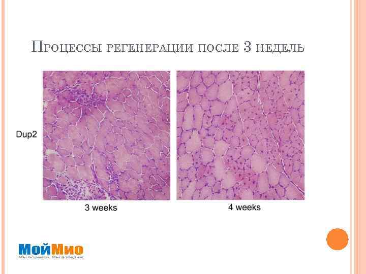 ПРОЦЕССЫ РЕГЕНЕРАЦИИ ПОСЛЕ 3 НЕДЕЛЬ 