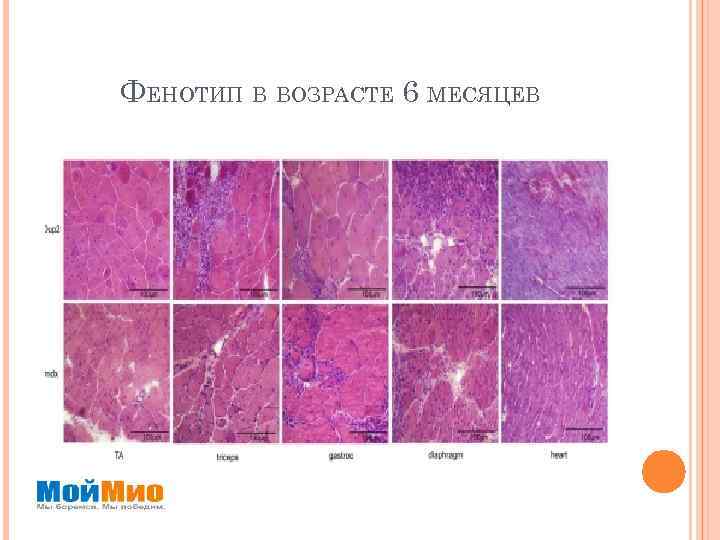 ФЕНОТИП В ВОЗРАСТЕ 6 МЕСЯЦЕВ 