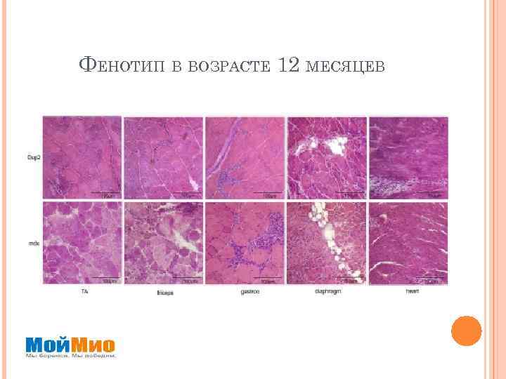 ФЕНОТИП В ВОЗРАСТЕ 12 МЕСЯЦЕВ 
