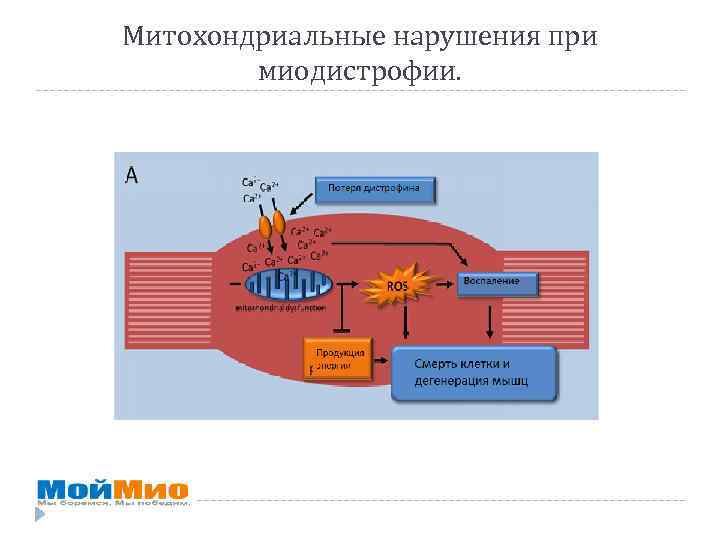 Митохондриальные нарушения при миодистрофии. 