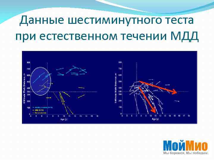 Данные шестиминутного теста при естественном течении МДД 