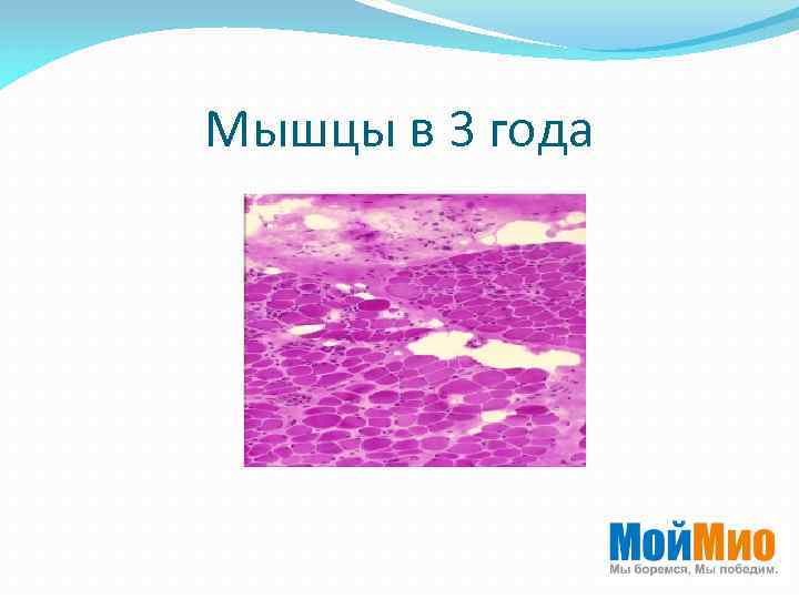 Мышцы в 3 года 
