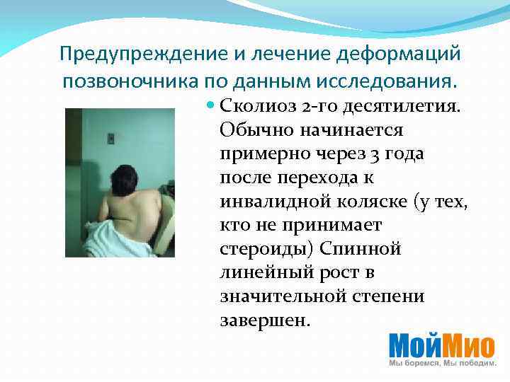 Предупреждение и лечение деформаций позвоночника по данным исследования. Сколиоз 2 -го десятилетия. Обычно начинается
