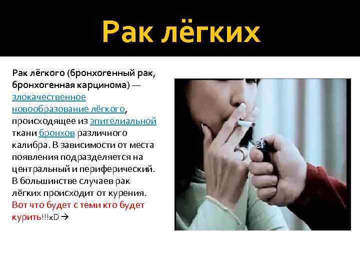 Рак лёгких Рак лёгкого (бронхогенный рак, бронхогенная карцинома) — злокачественное новообразование лёгкого, происходящее из