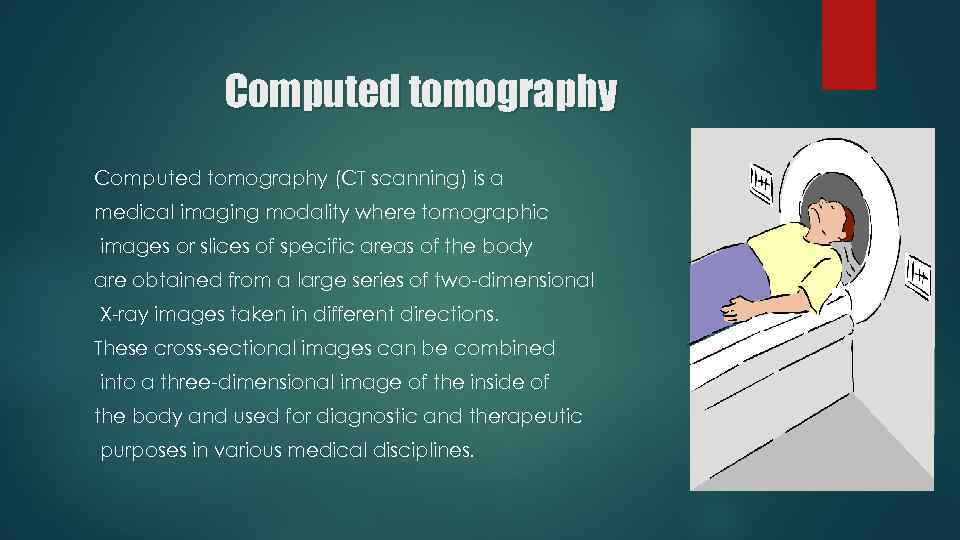  Computed tomography (CT scanning) is a medical imaging modality where tomographic images or