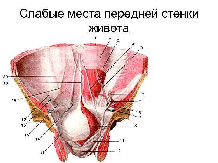 Слабые места передней стенки живота 