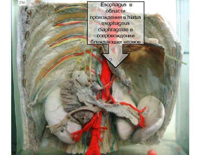 Esophagus в области прохождения в hiatus esophageus diaphragmae в сопровождении блуждающих нервов ? 