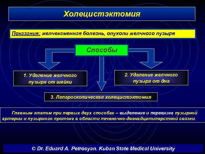 Холецистэктомия Показания: желчекаменная болезнь, опухоли желчного пузыря Способы 1. Удаление желчного пузыря от шейки