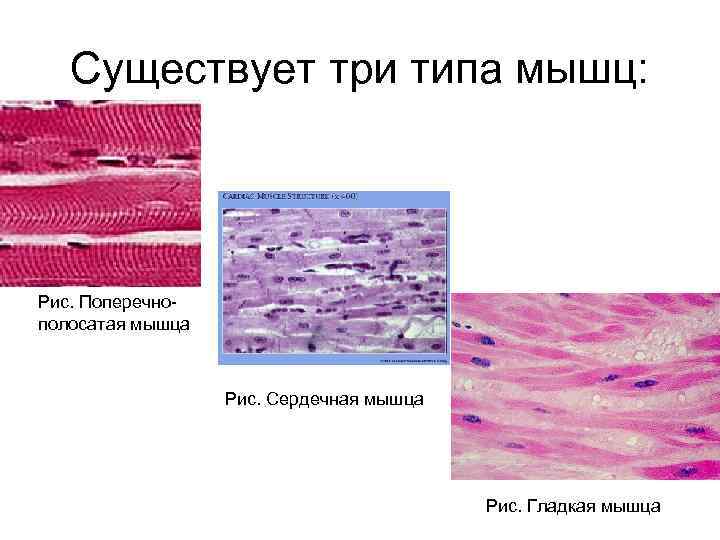 Существует три типа мышц: Рис. Поперечнополосатая мышца Рис. Сердечная мышца Рис. Гладкая мышца 