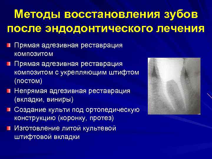 Методы обтурации корневых каналов презентация