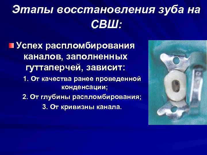 Этапы восстановления зуба на СВШ: Успех распломбирования каналов, заполненных гуттаперчей, зависит: 1. От качества