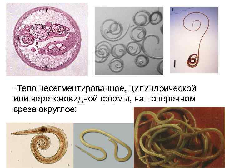 -Тело несегментированное, цилиндрической или веретеновидной формы, на поперечном срезе округлое; 