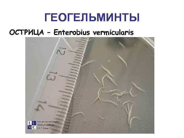 ГЕОГЕЛЬМИНТЫ ОСТРИЦА – Enterobius vermicularis 