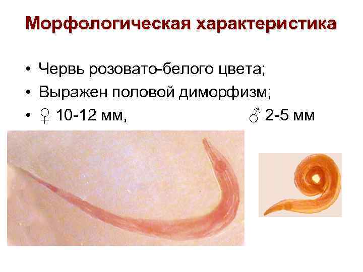 Морфологическая характеристика • Червь розовато-белого цвета; • Выражен половой диморфизм; • ♀ 10 -12
