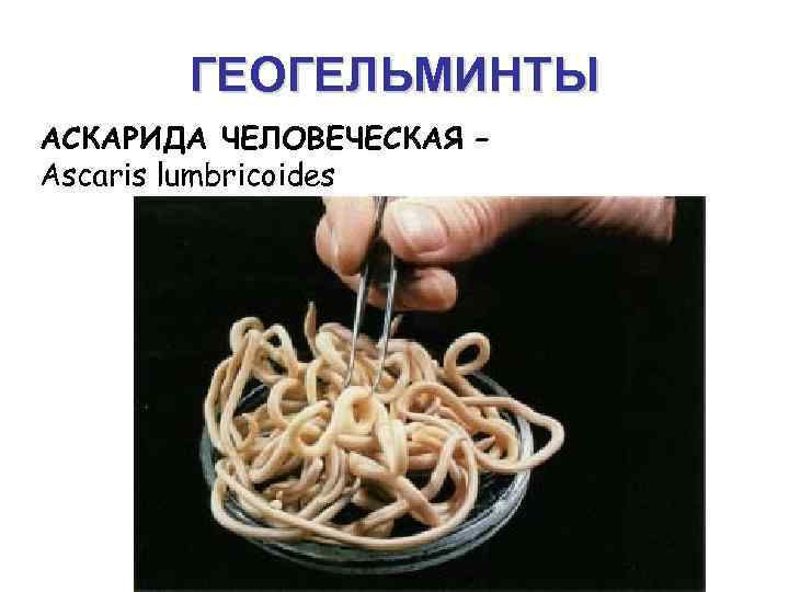 ГЕОГЕЛЬМИНТЫ АСКАРИДА ЧЕЛОВЕЧЕСКАЯ – Ascaris lumbricoides 