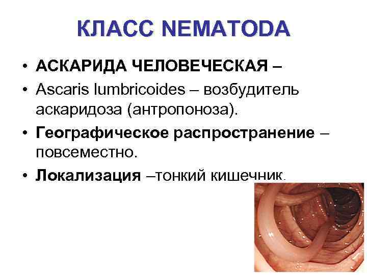 КЛАСС NEMATODA • АСКАРИДА ЧЕЛОВЕЧЕСКАЯ – • Ascaris lumbricoides – возбудитель аскаридоза (антропоноза). •