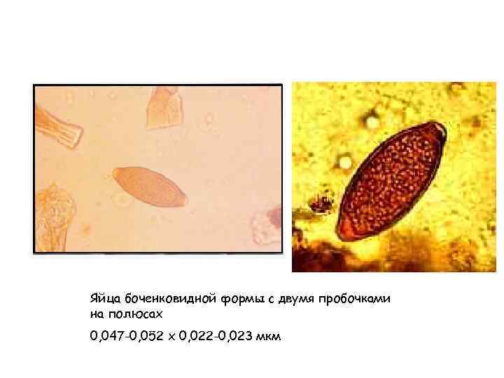 Яйца боченковидной формы с двумя пробочками на полюсах 0, 047 -0, 052 х 0,