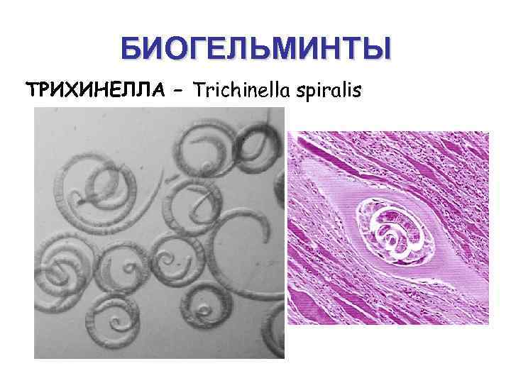 Биогельминтозы. Трихинелла биогельминт. Трихинелла (Trichinella spiralis классификация. Трихинелла человеческая.
