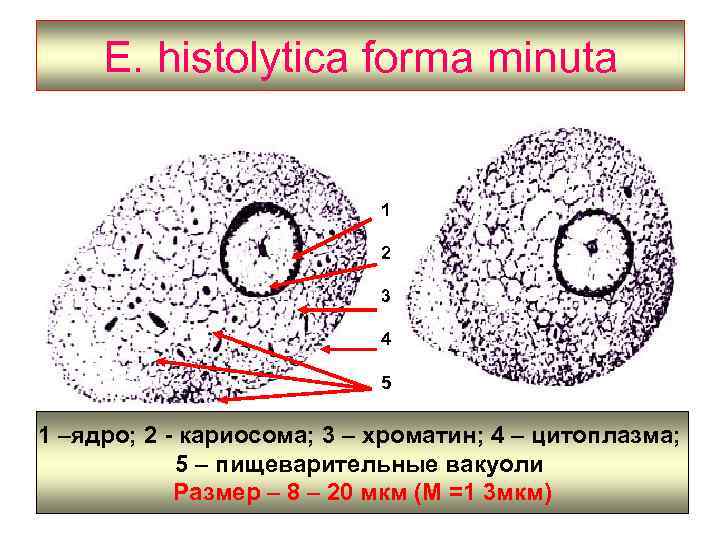 E. histolytica forma minuta 1 2 3 4 5 1 –ядро; 2 - кариосома;