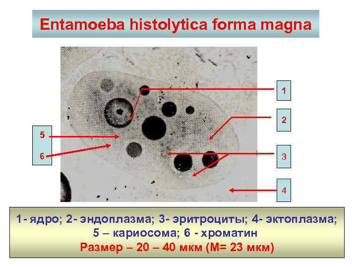 Entamoeba histolytica forma magna 1 2 5 6 3 4 1 - ядро; 2