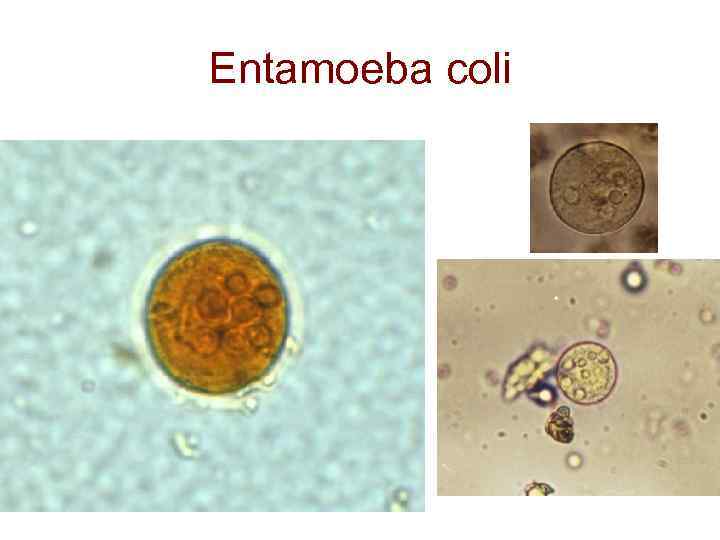 Entamoeba coli 