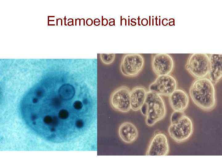 Entamoeba coli в кале. Цисты Entamoeba. Entamoeba coli заболевание. Entamoeba coli локализация.
