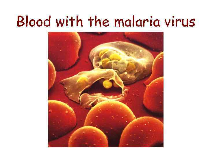 Blood with the malaria virus 