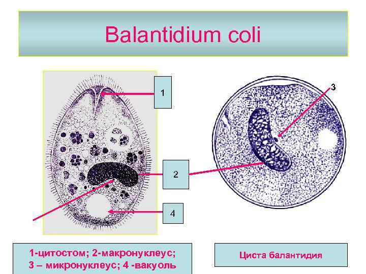 Balantidium coli 3 1 2 3 4 1 -цитостом; 2 -макронуклеус; 3 – микронуклеус;