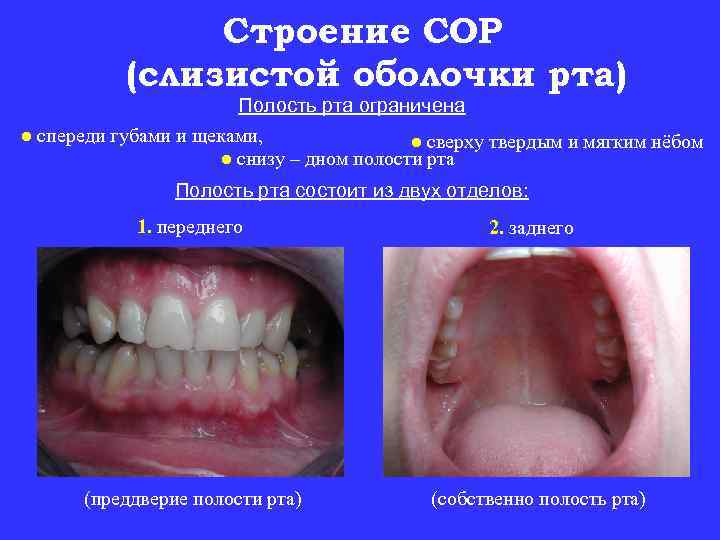 Строение СОР (слизистой оболочки рта) Полость рта ограничена ● спереди губами и щеками, ●