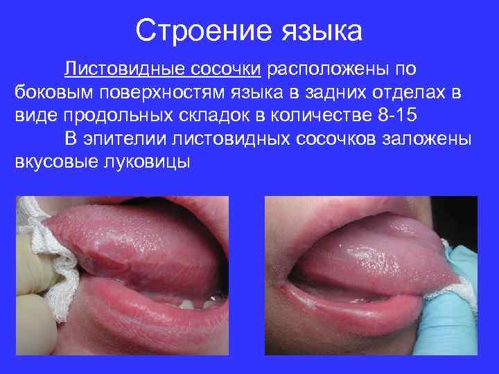 Строение языка Листовидные сосочки расположены по боковым поверхностям языка в задних отделах в виде