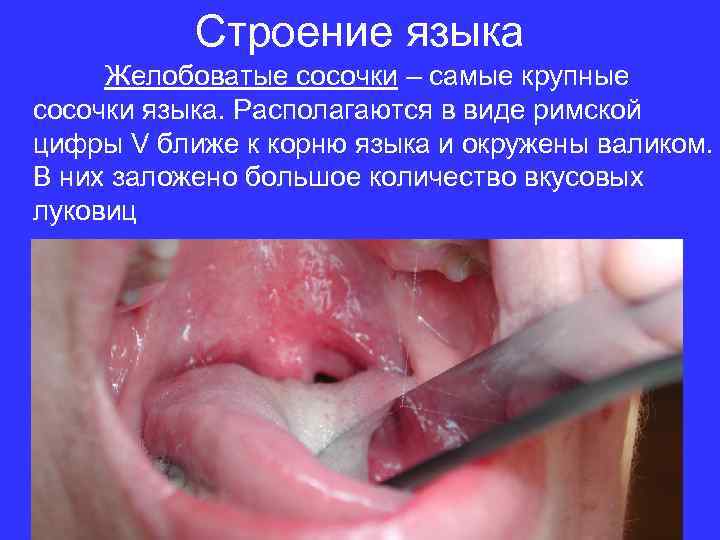 Строение языка Желобоватые сосочки – самые крупные сосочки языка. Располагаются в виде римской цифры