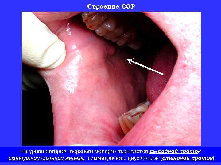 Строение СОР На уровне второго верхнего моляра открывается выводной проток околоушной слюнной железы симметрично