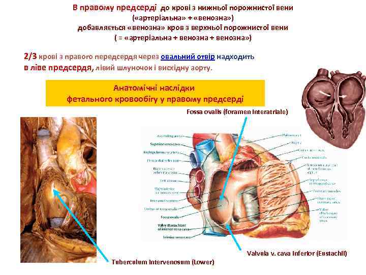 В правому предсерді до крові з нижньої порожнистої вени ( «артеріальна» + «венозна» )