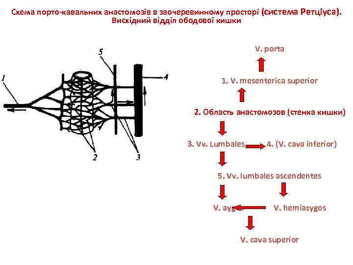 Cхема порто-кавальних анастомозів в заочеревинному просторі (система Ретціуса). Висхідний відділ ободової кишки V. porta