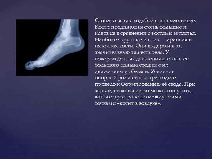 Стопа в связи с ходьбой стала массивнее. Кости предплюсны очень большие и крепкие в