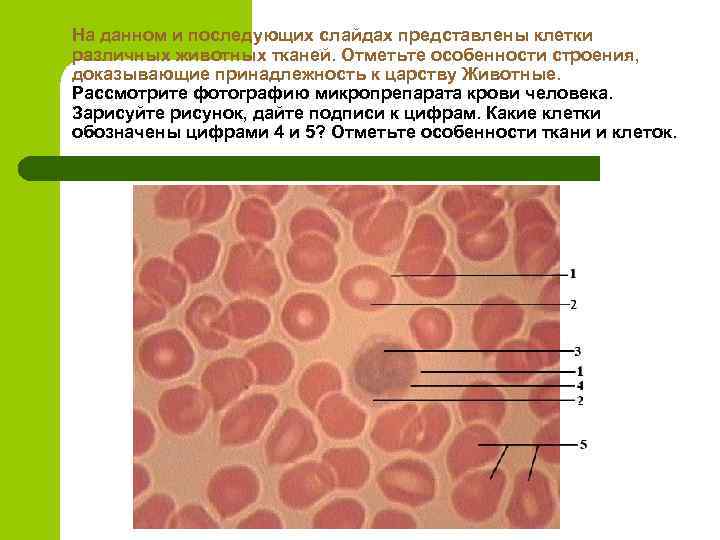 Уровни животной ткани. Особенности строения ткани крови человека. Особенности строения соединительной ткани кровь человека. Кровь ткань особенности. Особенности микропрепараты клеток.