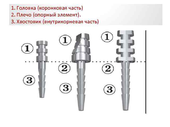 1. Головка (коронковая часть) 2. Плечо (опорный элемент). 3. Хвостовик (внутрикорневая часть) 