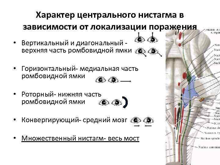 Центральный характер. Нистагм Центральный и периферический. Горизонтальный нистагм поражение. Нистагм при поражении какого нерва. При поражении какого нерва горизонтальный нистагм.