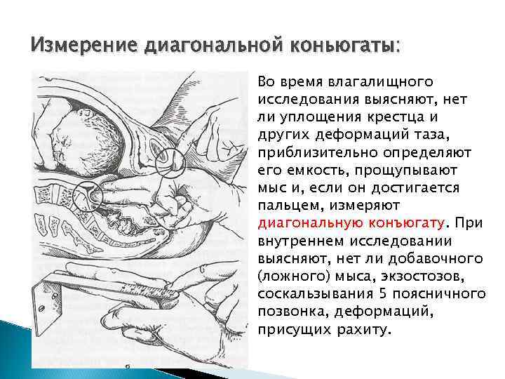 Прикроватный тест в акушерстве техника проведения