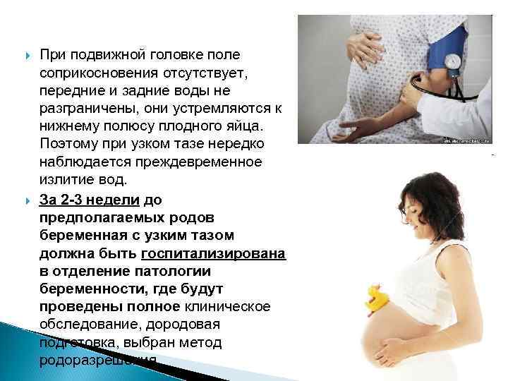  При подвижной головке поле соприкосновения отсутствует, передние и задние воды не разграничены, они