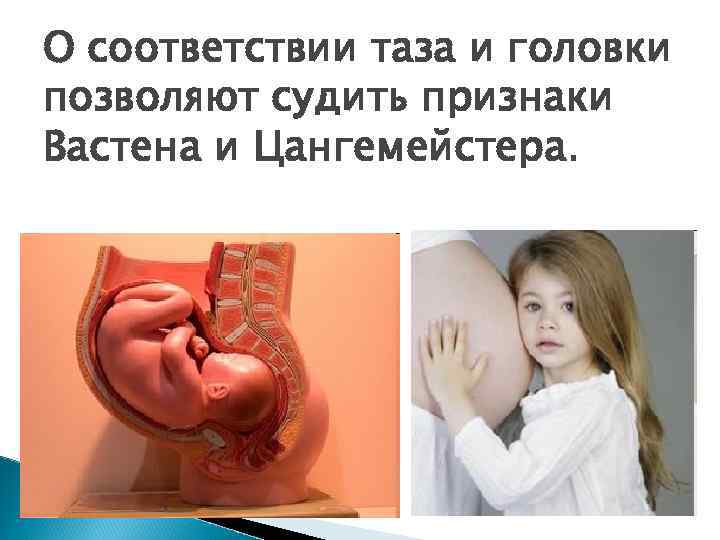 О соответствии таза и головки позволяют судить признаки Вастена и Цангемейстера. 