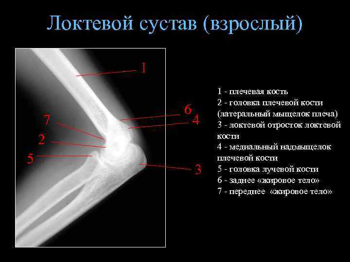 Локтевой сустав (взрослый) 1 7 2 5 6 4 3 1 - плечевая кость