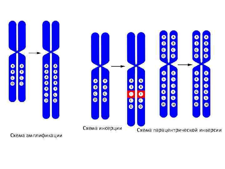 Схема инсерции Схема амплификации Схема парацентрической инверсии 