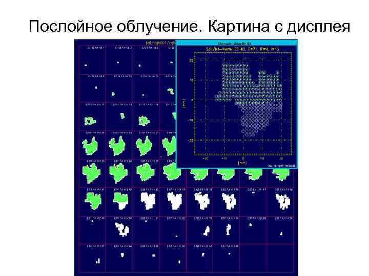 Послойное облучение. Картина с дисплея 