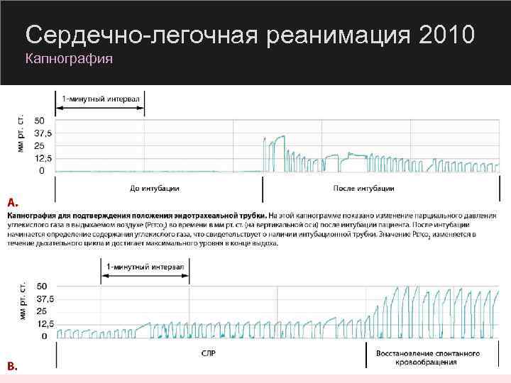 Сердечно-легочная реанимация 2010 Капнография 